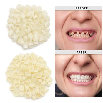 Временни Коронки за ремонт на зъбите Затворете Предния Моляр Преден / заден Зъб Бели Капачки за Липсващия Счупен Зъб Аксесоар