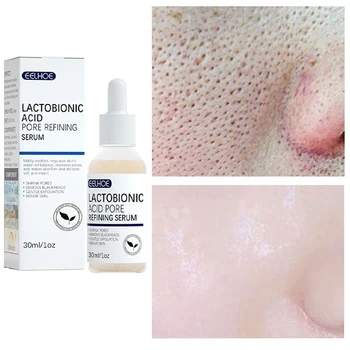 Лактобионовая киселина, хиалуронова киселина, сужающая порите серум за лице, хидратиращи, питающая, разглаживающая порите, лечебното копър Фирма на Корейската козметика